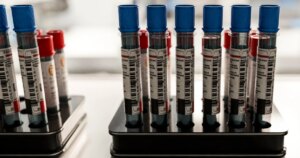 260420-blood-vials-stock-ew-224p-06cb58.jpg