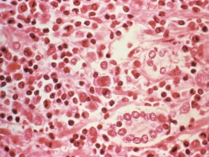 2017-07-06T234315Z_70732478_RC1D8FFAFA10_RTRMADP_3_WASHINGTON-HANTAVIRUS-1777842121.jpg