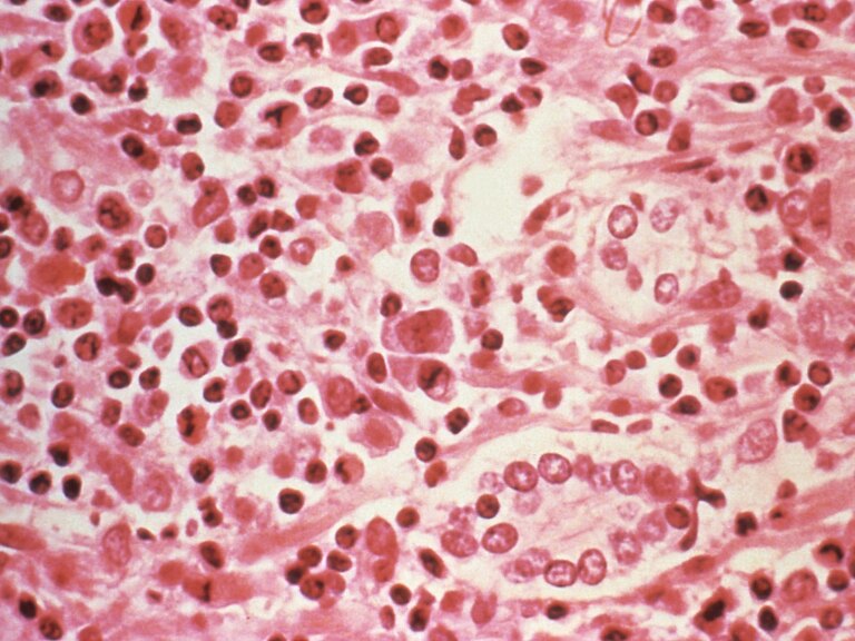 2017-07-06T234315Z_70732478_RC1D8FFAFA10_RTRMADP_3_WASHINGTON-HANTAVIRUS-1777842121.jpg