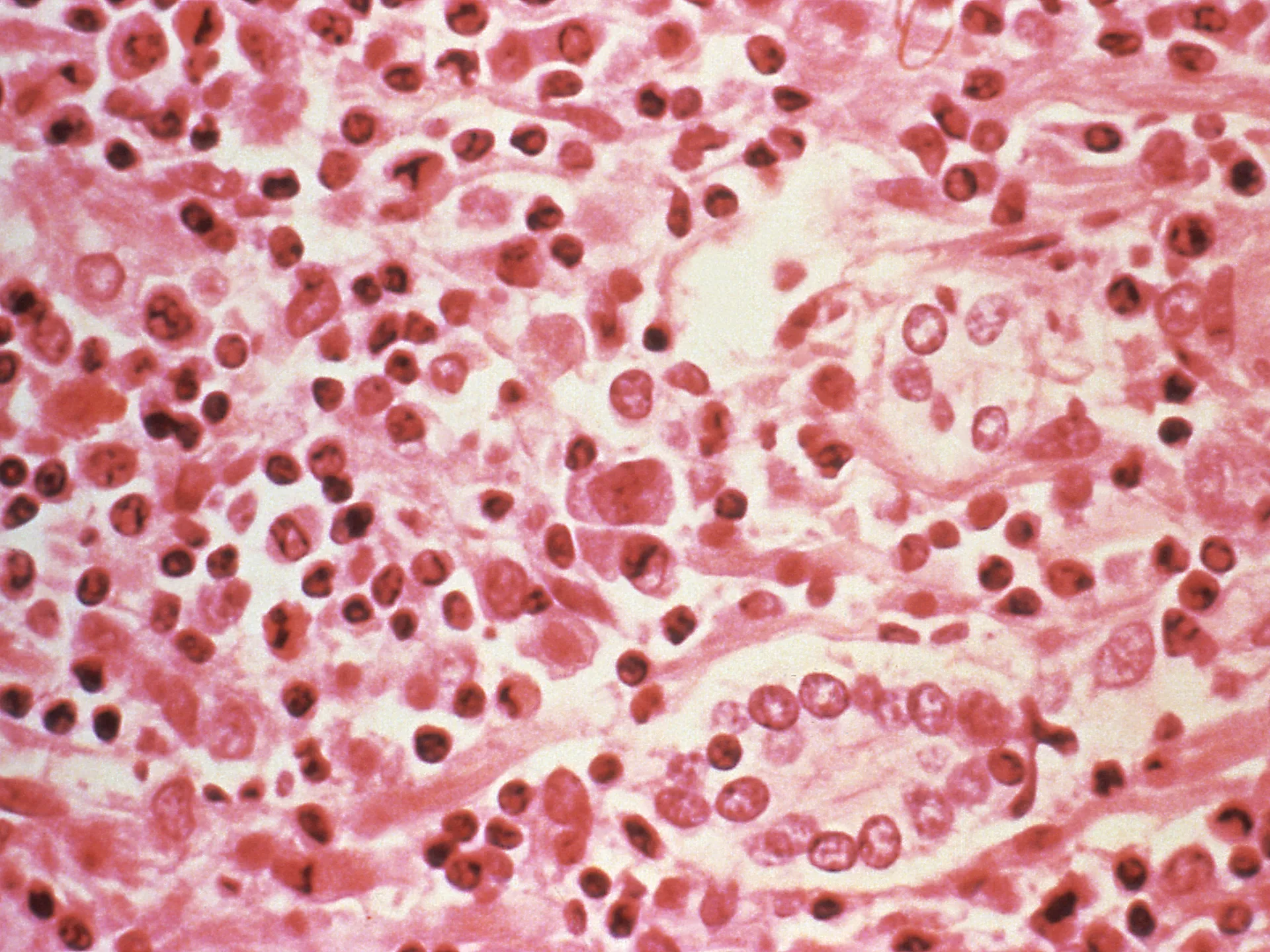 2017-07-06T234315Z_70732478_RC1D8FFAFA10_RTRMADP_3_WASHINGTON-HANTAVIRUS-1777842121.jpg