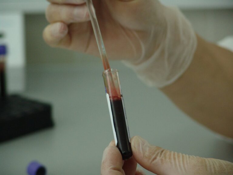 3-dead-3-ill-in-suspected-hantavirus-outbreak-on-cruise-ship.jpg