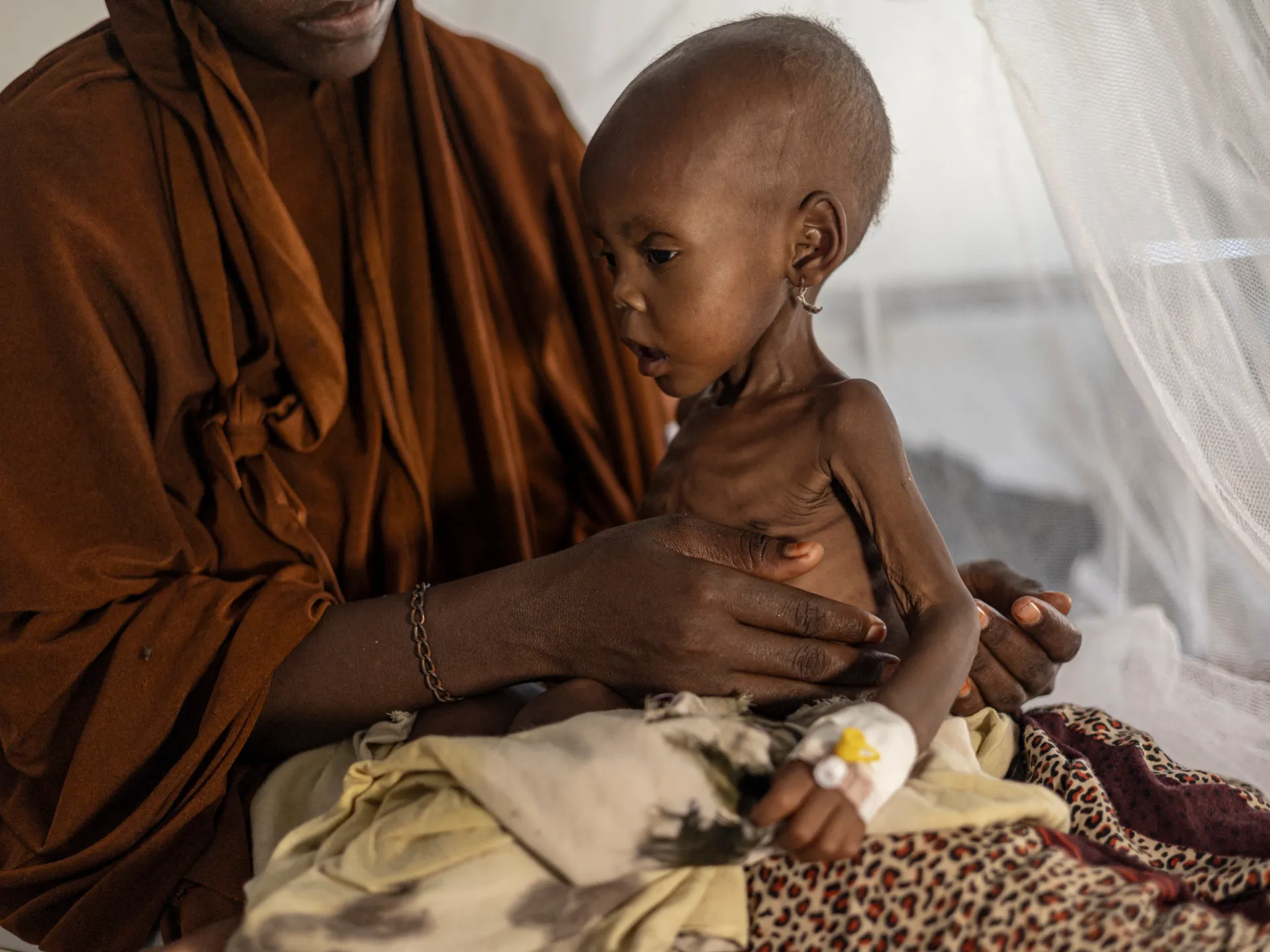 AFP__20260422__A8NE79T__v6__HighRes__SomaliaEnvironmentConflictHealthDisplaced-1778132117.jpg