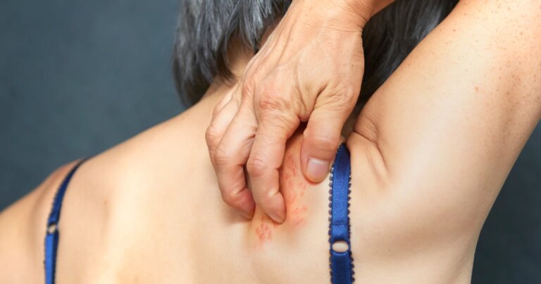 250710-shingles-se-1226p-f27aed.jpg