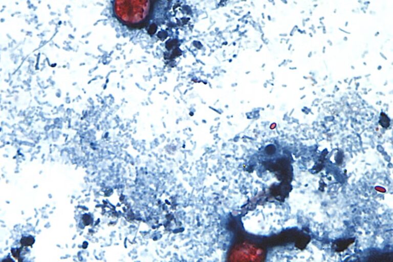 EEUU-CYCLOSPORA-QUC389_SABER_55141.jpg