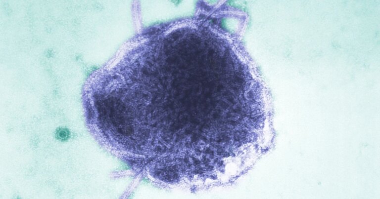 250716-measles-se-523p-444229.jpg