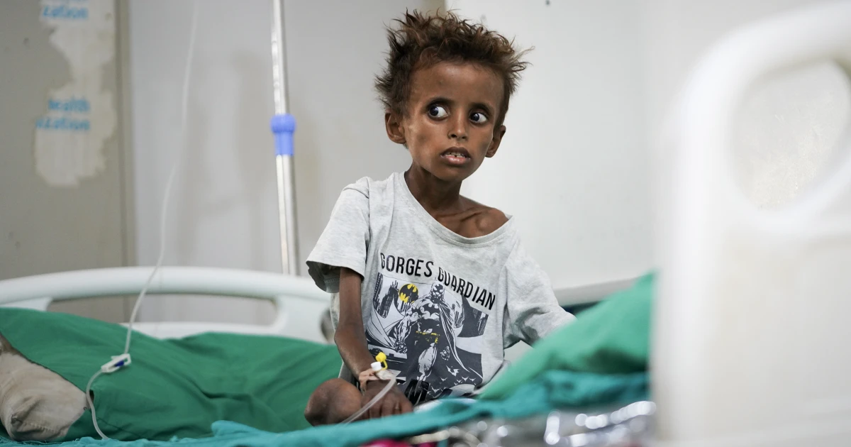 260925-yemen-war-ww-1641-c2e901.jpg