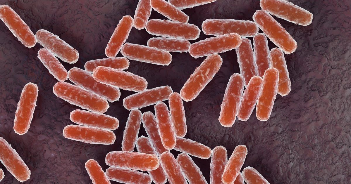 261005-Yersinia-pestis-rs-f81dd3.jpg